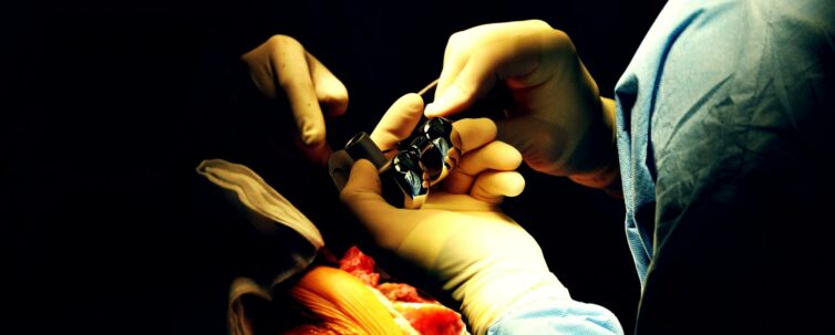 Prothesis of the knee hospital operation