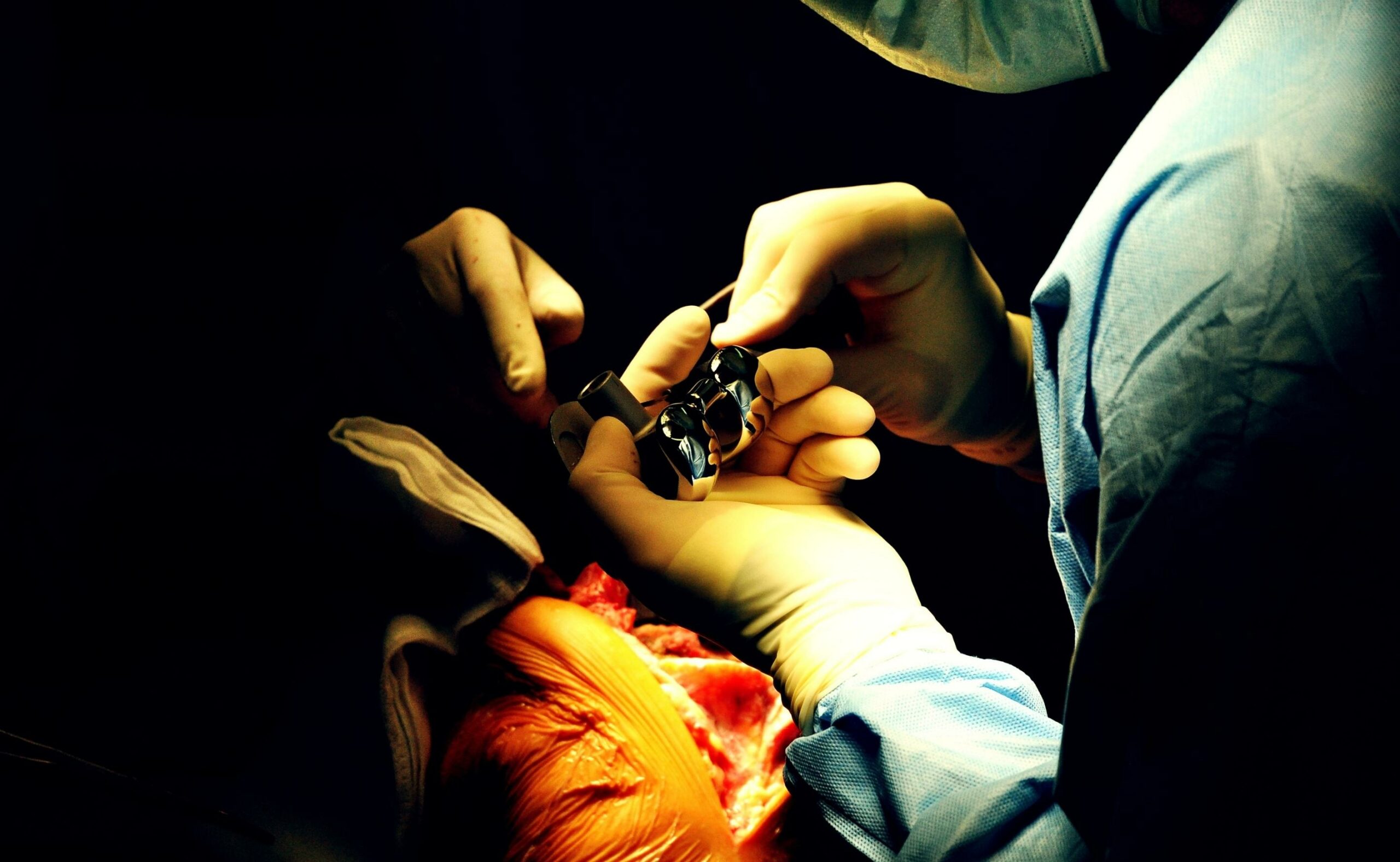 Prothesis of the knee hospital operation