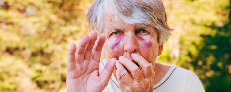 Scared and maltreated senior woman with big bruises