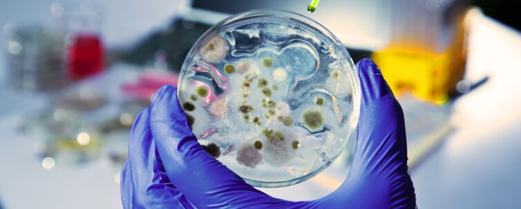 growth on petri dish