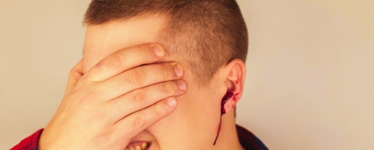 A man whose ear is bleeding vascular rapture, damage to the tympanic membrane